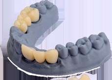 3D Accuprint IBT — راتنج قوالب غير مباشرة